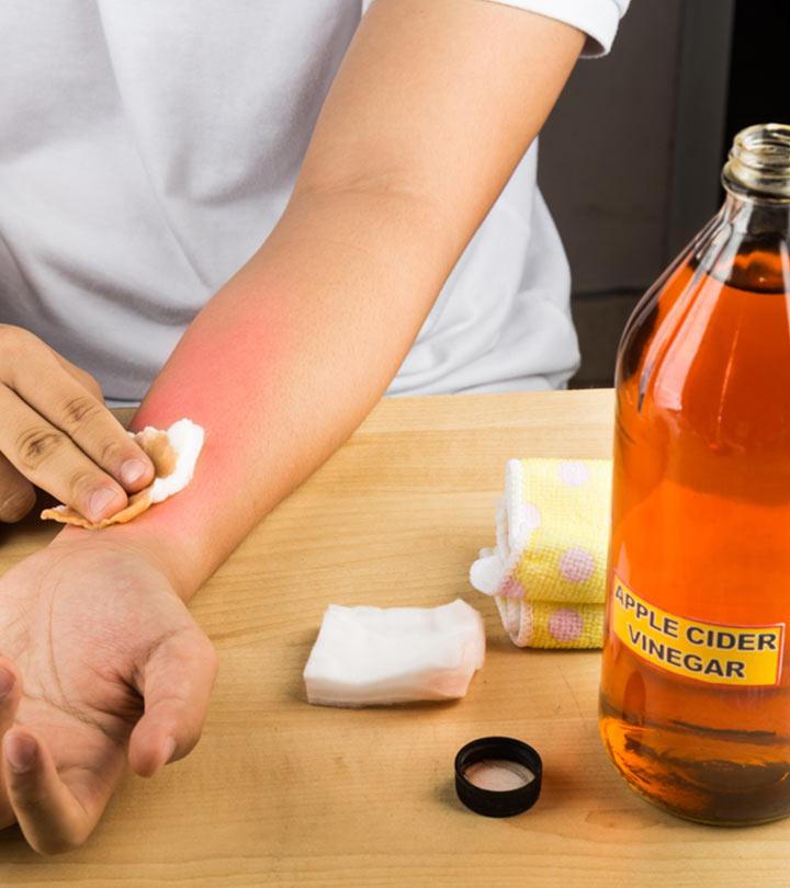 Person using Apple Cider Vinegar on skin
